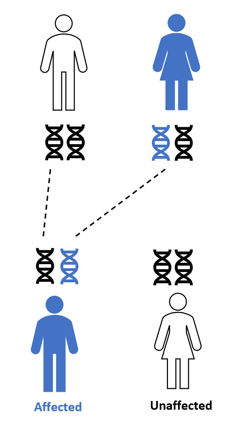 A diagram showing inheritance of a dominant genetic trait.  Gene pairs of affected parent and unaffected parent are represented below each figure.  Gene pairs of affected and unaffected children are represented above each figure.